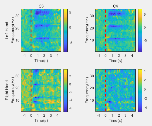 [Matlab] 短时傅里叶变换spectrogram函数第2张