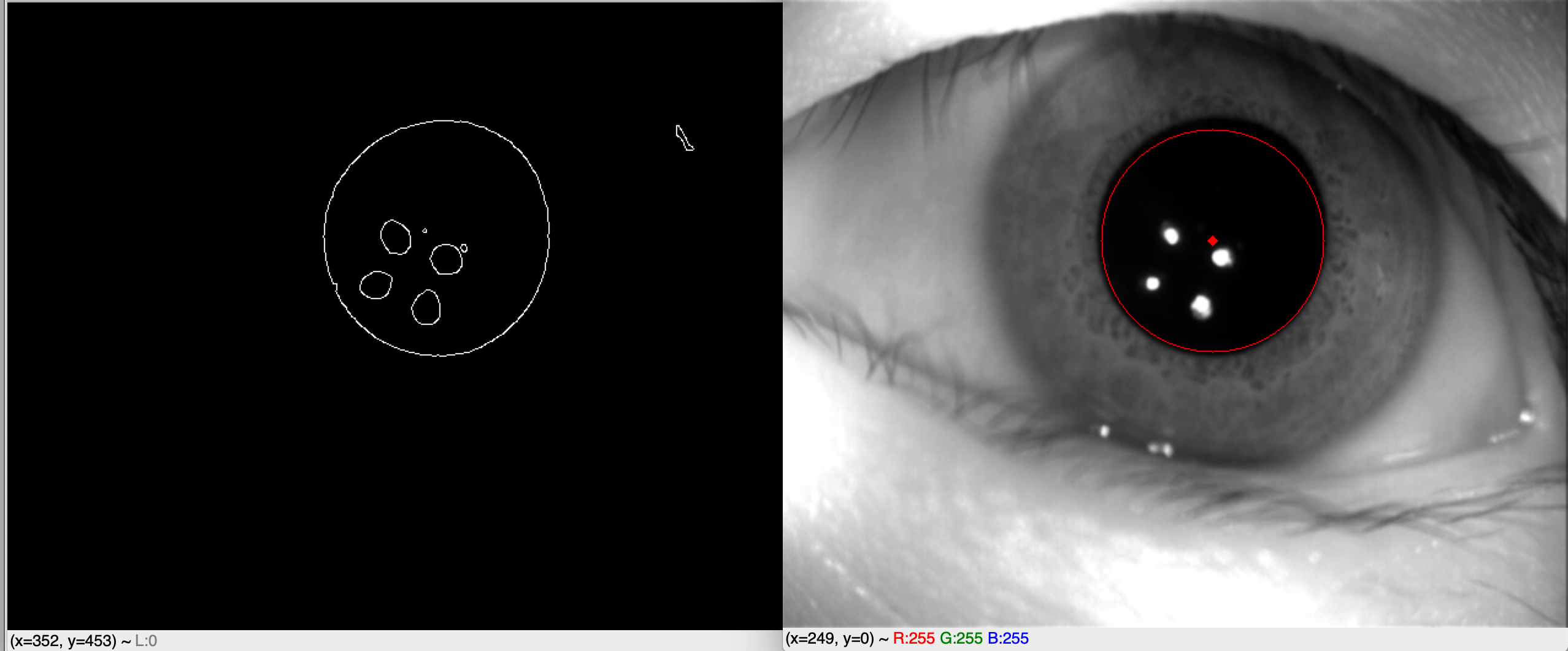 使用霍夫变换检测虹膜内圆的注意事项第2张
